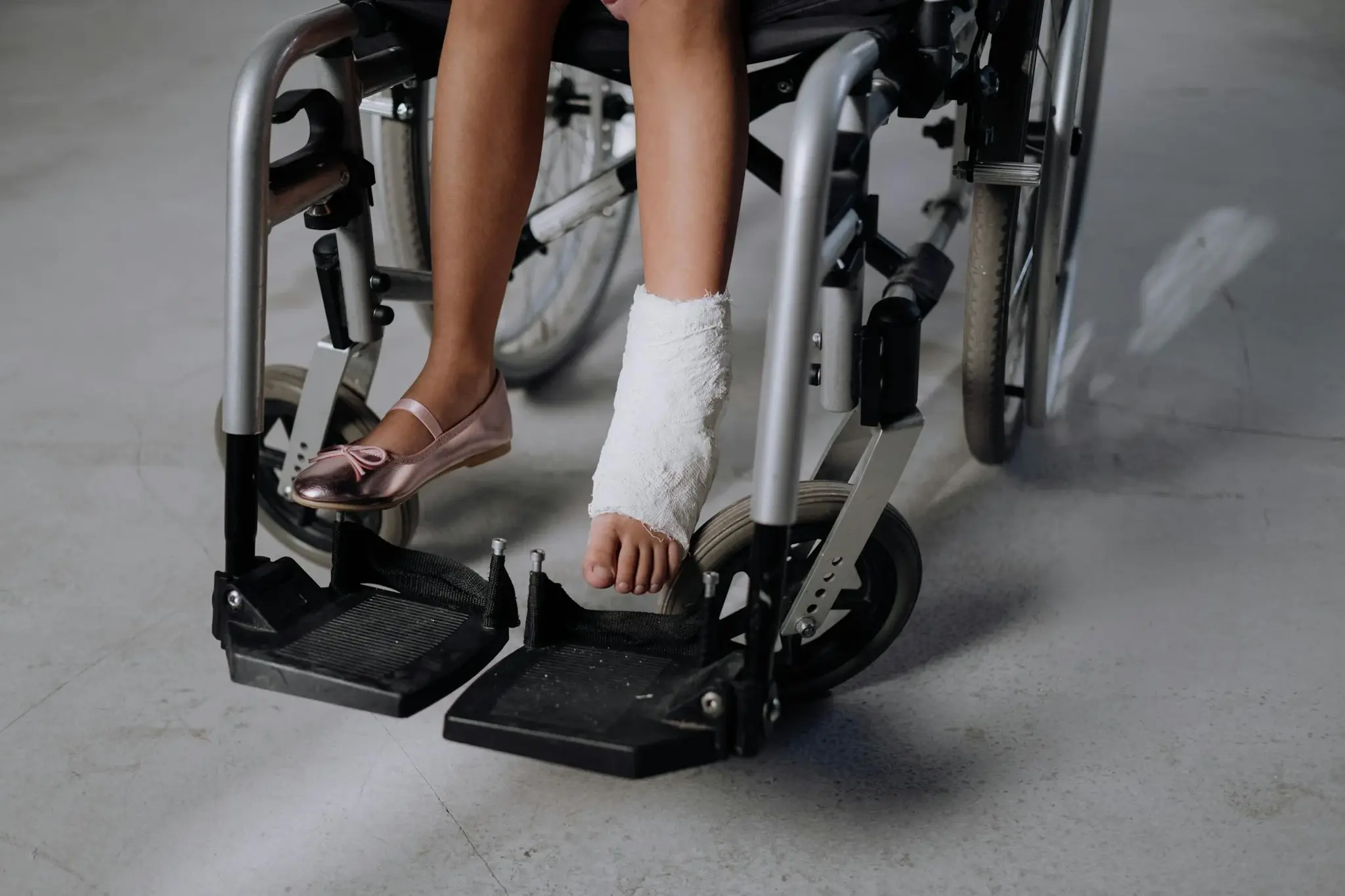 Pernas de criança sentada em cadeira de rodas, com um pé engessado apoiado no pedal